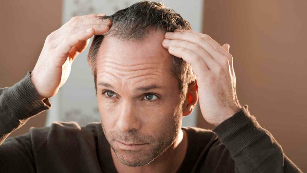 customized compounding options for hair loss treatment